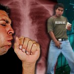 Deadly Strain of Tuberculosis Hits U.S.